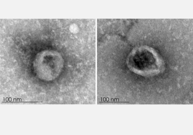 ArbofEVer
